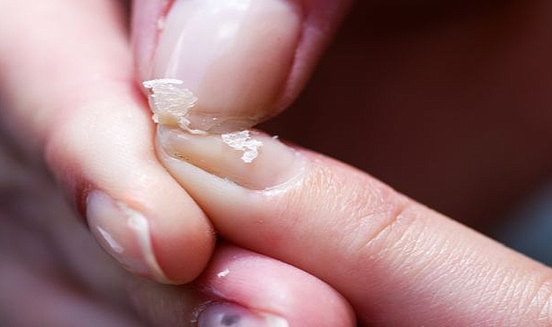 TIRNAKLARDA 8 ÖNEMLİ HASTALIK SİNYALİ!